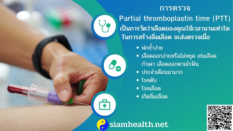 การตรวจ Partial thromboplastin time 